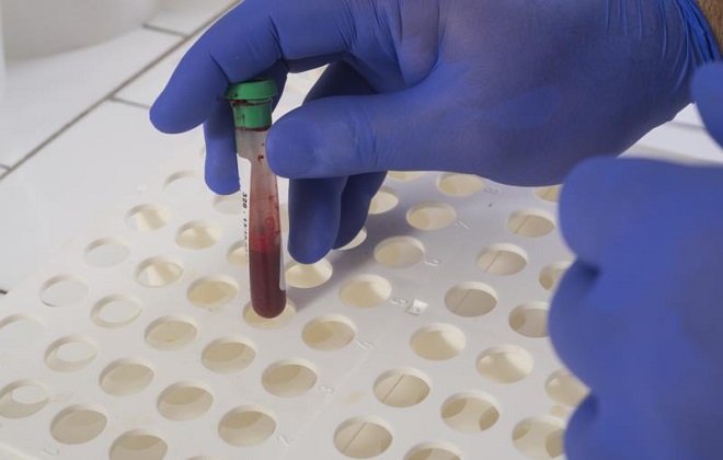 Лабораторная подставка для анализов крови