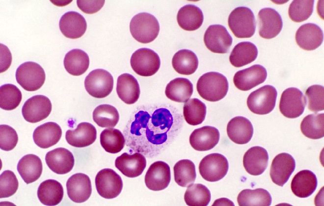 Клетка крови увеличенная на молекулярном уровне под микроскопом