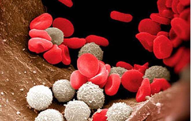 Наглядно повышены нейтрофилы сегментоядерные в крови