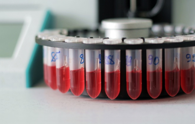 Проверка крови на содержание крупных тромбоцитов