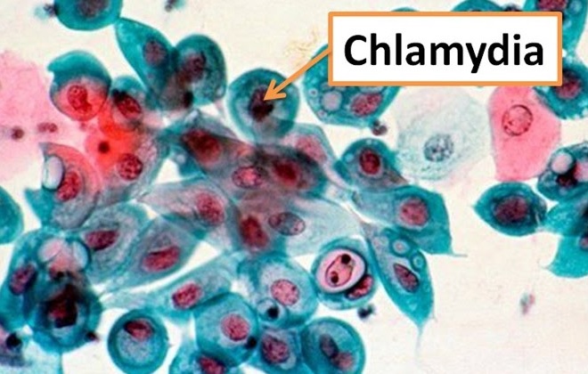 Молекула хламидии обнаруженная в крови человека