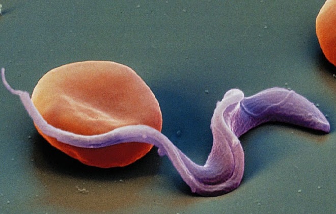 Паразитарная микроба токсоплазмоза