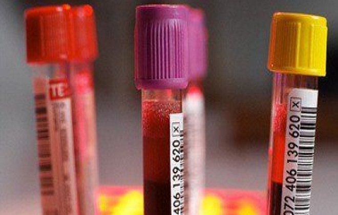 Три образца крови с изменениями в гормональном фоне