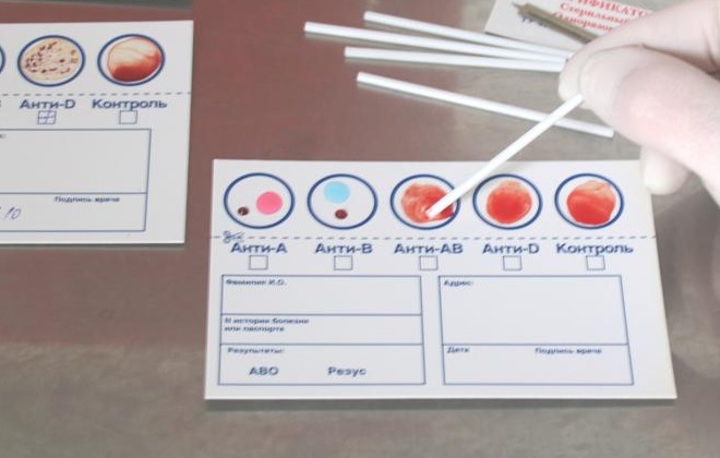 Домашний метод определения группы крови и резуса