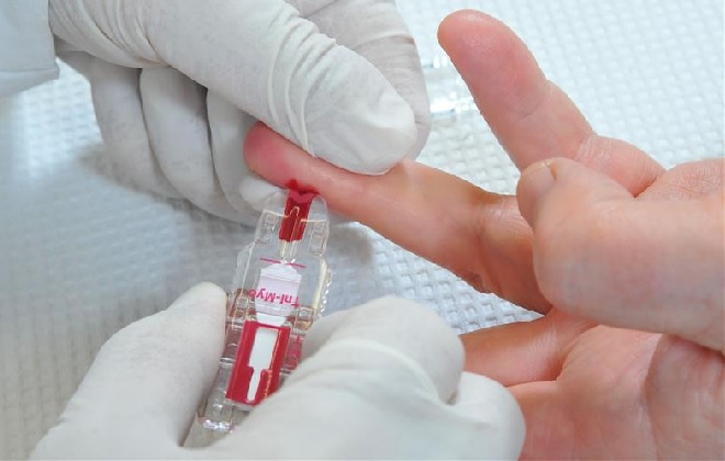 Новый прибор забора крови из пальца на общий анализ