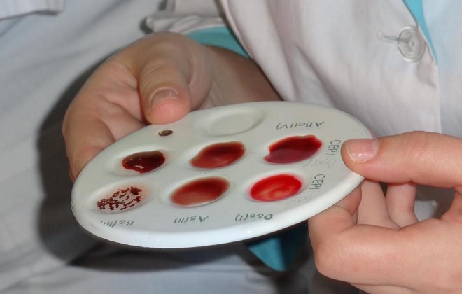 Процедура определения группы крови цоликлонами