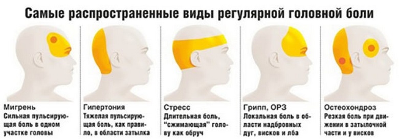 Разновидности головных болей