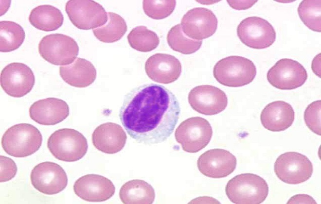 Повышенные лимфоциты в крови
