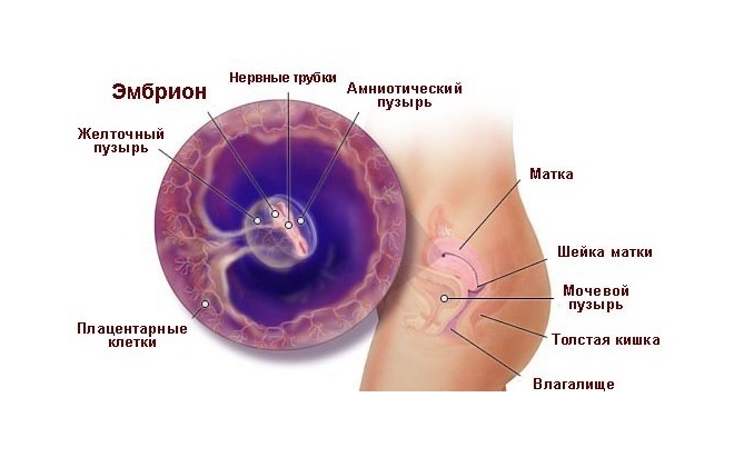 Размещение эмбриона в матке