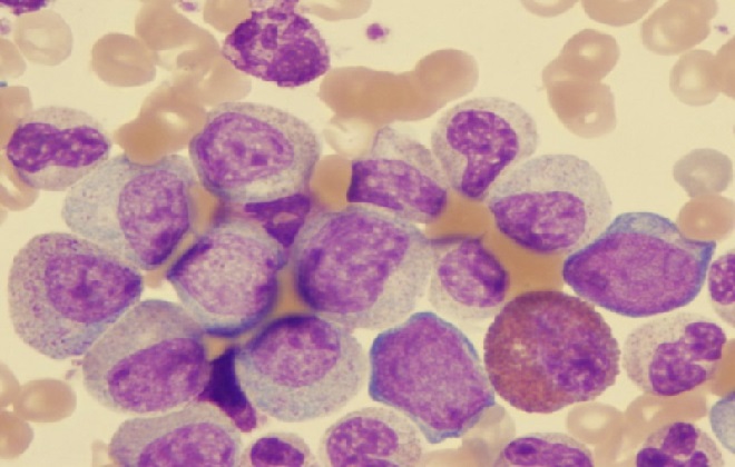 Фиолетовые клетки в русле