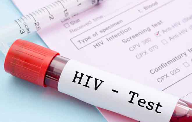 Сколько действителен анализ на ВИЧ: годен, действует, времени, действует, кровь